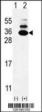 Anti-KXD1 Rabbit Polyclonal Antibody (APC (Allophycocyanin))