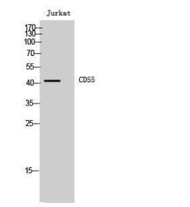 Western blot analysis of Jurkat cells using Anti-CD55 Antibody