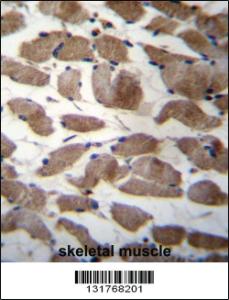 Anti-ACTN3 Rabbit Polyclonal Antibody