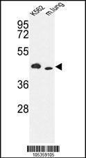 Anti-Inositol 1,4,5-trisphosphate 3-kinase A Rabbit Polyclonal Antibody (Biotin)