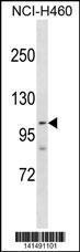 Anti-PARP1 Rabbit Polyclonal Antibody (AP (Alkaline Phosphatase))