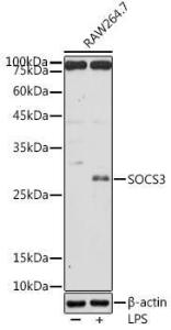 Western blot analysis of extracts of RAW264. 7 cells, using Anti-SOCS3 Antibody (A12687) at 1:500 dilution