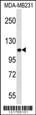 Anti-ACTN3 Rabbit Polyclonal Antibody