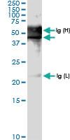 Anti-PDCD2 Rabbit Polyclonal Antibody