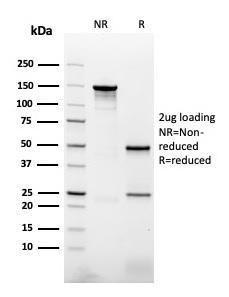 SDS-PAGE analysis of Anti-NAPSIN A Antibody [NAPSA/3307] under non-reduced and reduced conditions; showing intact IgG and intact heavy and light chains, respectively. SDS-PAGE analysis confirms the integrity and purity of the antibody