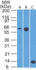 Anti-CCR6 Rat Monoclonal Antibody [clone: 18B9E6]