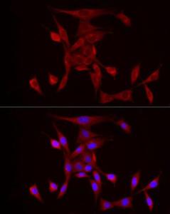 Anti-PDE4A Rabbit Polyclonal Antibody