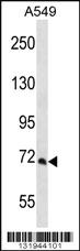 Anti-PCCA Rabbit Polyclonal Antibody