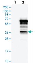 Anti-SASH3 Rabbit Polyclonal Antibody