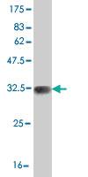 Anti-SCN11A Mouse Monoclonal Antibody [clone: 6E1]