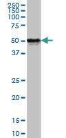 Anti-FOXA1 Mouse monoclonal antibody [clone: 4F6]