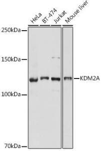 Western blot analysis of extracts of various cell lines, using Anti-KDM2A Antibody (A307258) at 1:1,000 dilution. The secondary antibody was Goat Anti-Rabbit IgG H&L Antibody (HRP) at 1:10,000 dilution.