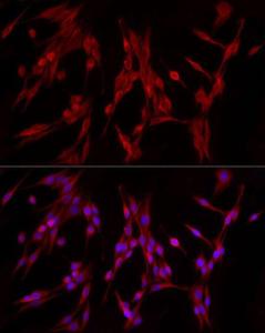 Anti-PDE4A Rabbit Polyclonal Antibody