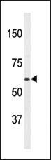 Anti-PAT1(APPBP2) Rabbit Polyclonal Antibody