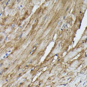 Immunohistochemistry analysis of paraffin-embedded mouse heart using Anti-SOCS3 Antibody (A12687) at a dilution of 1:50 (40X lens). Perform high pressure antigen retrieval with 10 mM citrate buffer pH 6.0 before commencing with IHC staining protocol