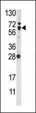 Anti-NFE2L2 Rabbit Polyclonal Antibody