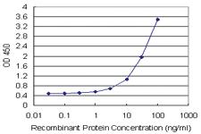 Anti-ENG Antibody Pair