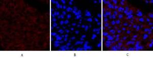 Immunofluorescence analysis of human liver cancer tissue using Anti-Cox2 Antibody (red) at 1:200 (4°C overnight). Cy3 labelled secondary antibody was used at 1:300 (RT 50min). Panel A: Target. Panel B: DAPI. Panel C: Merge.