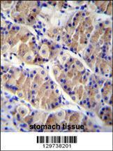 Anti-LRRC38 Rabbit Polyclonal Antibody (AP (Alkaline Phosphatase))