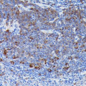 Immunohistochemistry analysis of paraffin-embedded mouse spleen using Anti-SOCS3 Antibody (A12687) at a dilution of 1:50 (40X lens). Perform high pressure antigen retrieval with 10 mM citrate buffer pH 6.0 before commencing with IHC staining protocol