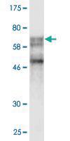 Anti-SSB Mouse Monoclonal Antibody [clone: 3H7-F7]