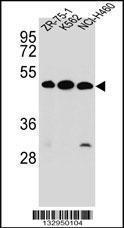 Anti-KREMEN2 Rabbit Polyclonal Antibody (APC (Allophycocyanin))