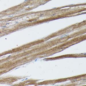 Immunohistochemistry analysis of paraffin-embedded rat heart using Anti-SOCS3 Antibody (A12687) at a dilution of 1:50 (40X lens). Perform high pressure antigen retrieval with 10 mM citrate buffer pH 6.0 before commencing with IHC staining protocol