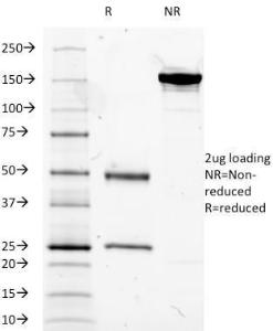 SDS-PAGE analysis of Anti-CD14 Antibody [LPSR/2385] under non-reduced and reduced conditions; showing intact IgG and intact heavy and light chains, respectively. SDS-PAGE analysis confirms the integrity and purity of the antibody