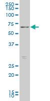 Anti-FOXO1 Mouse Monoclonal Antibody [clone: 3A10]