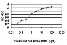 Anti-KSR2 Mouse Monoclonal Antibody [clone: 4H2]