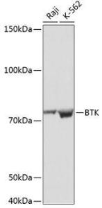 Western blot analysis of extracts of various cell lines, using Anti-BTK Antibody [ARC0485] (A308271) at 1:1000 dilution. The secondary Antibody was Goat Anti-Rabbit IgG H&L Antibody (HRP) at 1:10000 dilution. Lysates/proteins were present at 25 µg per lane