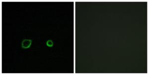 Anti-CNTN4 antibody