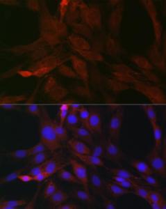 Immunofluorescence analysis of C6 cells using Anti-SOCS3 Antibody (A12687) at a dilution of 1:50 (40X lens). DAPI was used to stain the cell nuclei (blue)