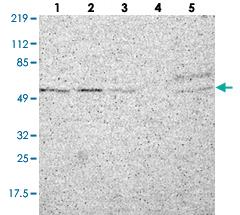 Anti-RTCB Rabbit Polyclonal Antibody