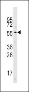 Anti-CDC25A Rabbit Polyclonal Antibody (APC (Allophycocyanin))