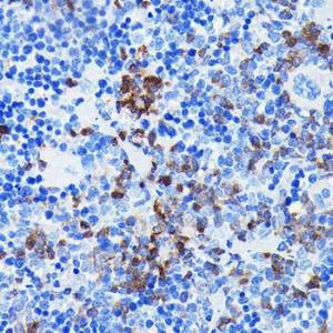 Immunohistochemistry analysis of paraffin-embedded mouse spleen using Anti-BTK Antibody [ARC0485] (A308271) at a dilution of 1:100 (40X lens). Perform microwave antigen retrieval with 10 mM PBS buffer pH 7.2 before commencing with IHC staining protocol