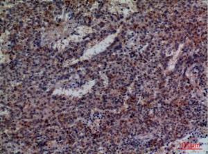 Immunohistochemical analysis of paraffin-embedded human lung cancer using Anti-CD48 Antibody