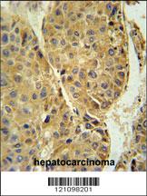 Anti-CRHBP Rabbit Polyclonal Antibody