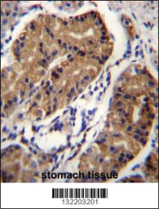 Anti-DCC Rabbit Polyclonal Antibody