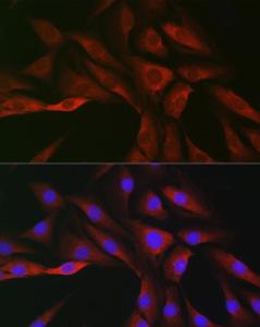 Immunofluorescence analysis of NIH/3T3 cells using Anti-SOCS3 Antibody (A12687) at a dilution of 1:50 (40X lens). DAPI was used to stain the cell nuclei (blue)