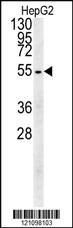 Anti-CRHBP Rabbit Polyclonal Antibody