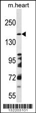 Anti-DCC Rabbit Polyclonal Antibody