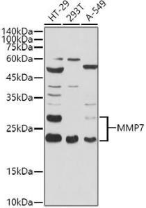 Anti-MMP7 Rabbit Polyclonal Antibody