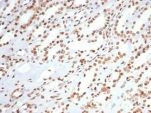 Immunohistochemical analysis of formalin-fixed, paraffin-embedded human colon carcinoma tissue using Anti-Ku80 Antibody [XRCC5/7315]