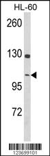 Anti-DNM3 Rabbit Polyclonal Antibody [clone: 384CT24.1.3.4]