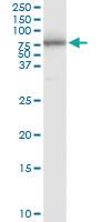 Anti-PI4K2A Polyclonal Antibody Pair