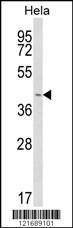 Anti-INSIG1 Rabbit Polyclonal Antibody (AP (Alkaline Phosphatase))