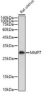 Anti-MMP7 Rabbit Polyclonal Antibody