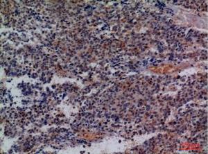 Immunohistochemical analysis of paraffin-embedded human lung cancer using Anti-CD48 Antibody