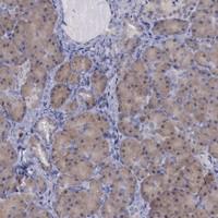 Anti-CEP128 Rabbit Polyclonal Antibody